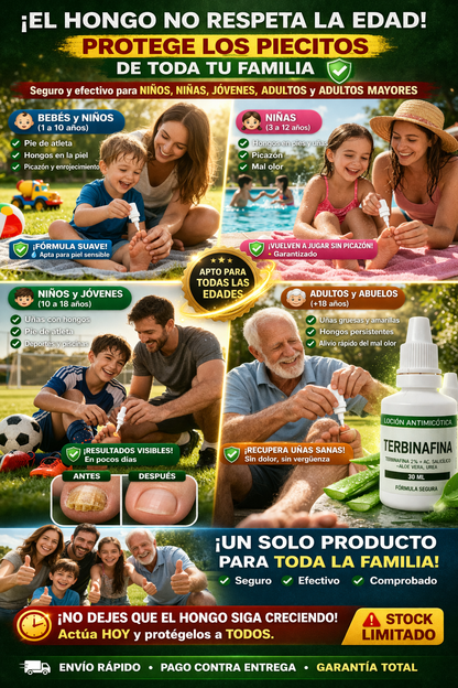 terbinafina loción antimicótica