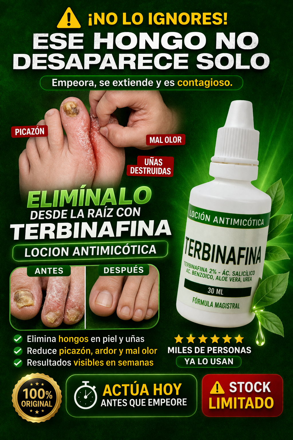 terbinafina loción antimicótica