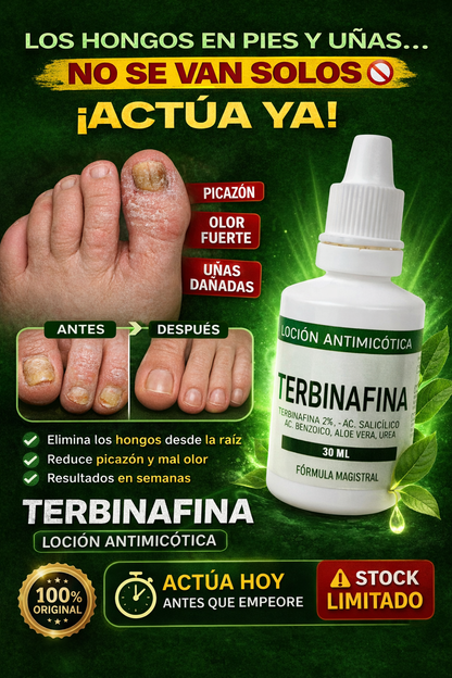 terbinafina loción antimicótica