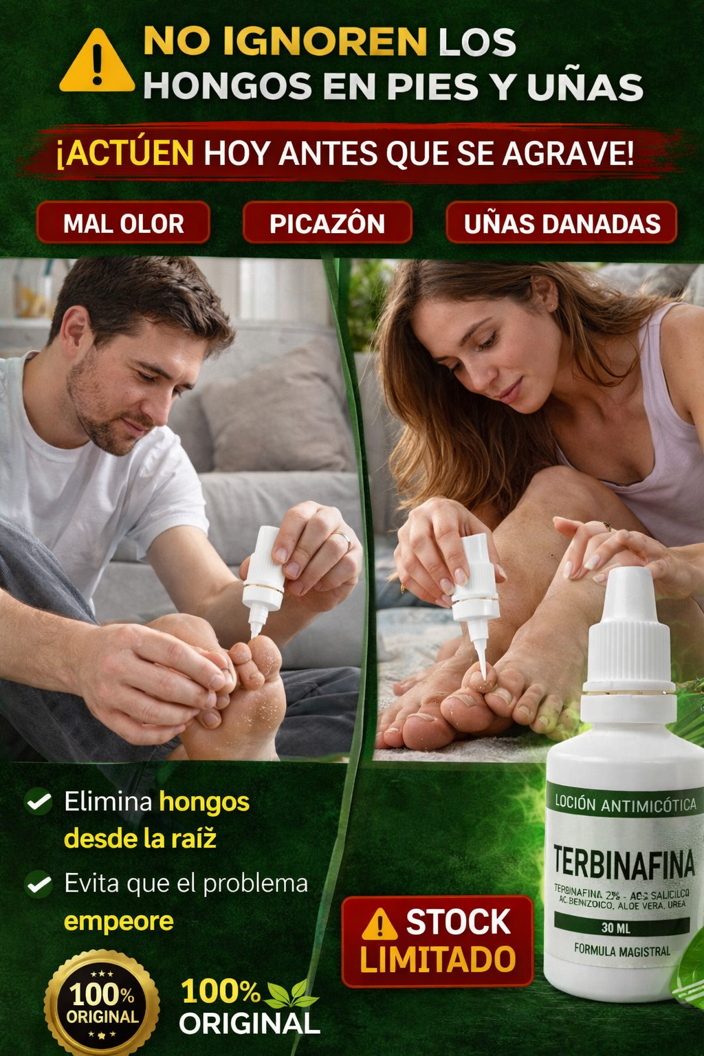 terbinafina loción antimicótica