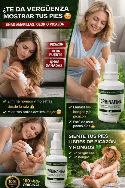 terbinafina loción antimicótica