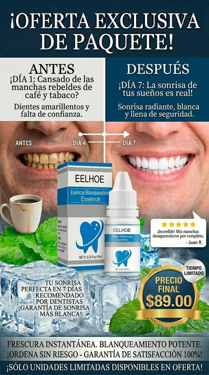 Solución para eliminar el sarro dental y las manchas Smilekit EELHOE™”